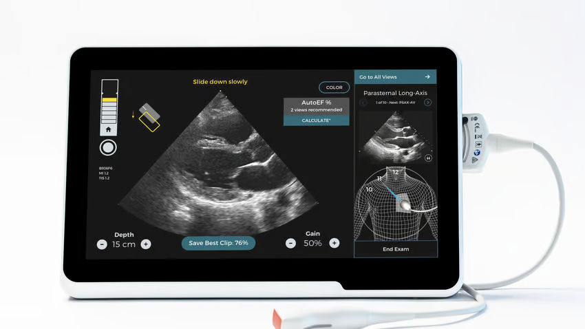 La société d’imagerie par ultrasons AI Caption Health devient la suite de l’acquisition de GE Healthcare